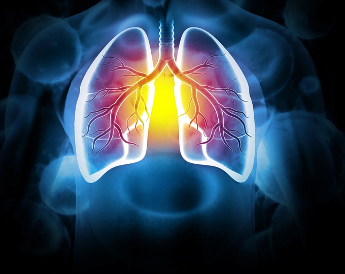 Повышение риска интерстициальных заболеваний легких у пациентов с воспалительным заболеванием кишечника