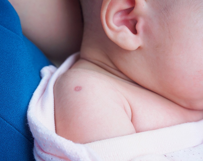 Безопасна ли вакцинация против туберкулеза у недоношенных детей? 