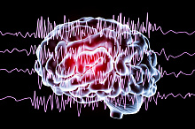 Эффективность и безопасность мидазолама у пациентов с эпилептическим статусом