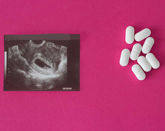 Рациональная фармакотерапия неполного спонтанного аборта. Результаты исследования MifeMiso
