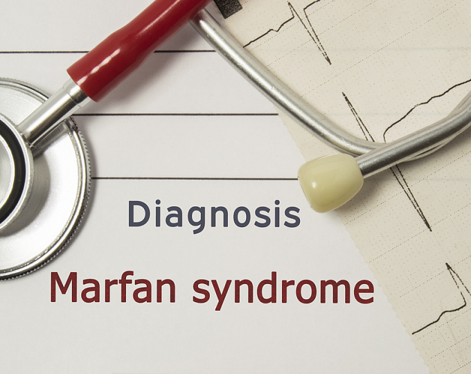 Лозартан у пациентов с синдромом Марфана: результаты отдаленного наблюдения за участниками исследования COMPARE