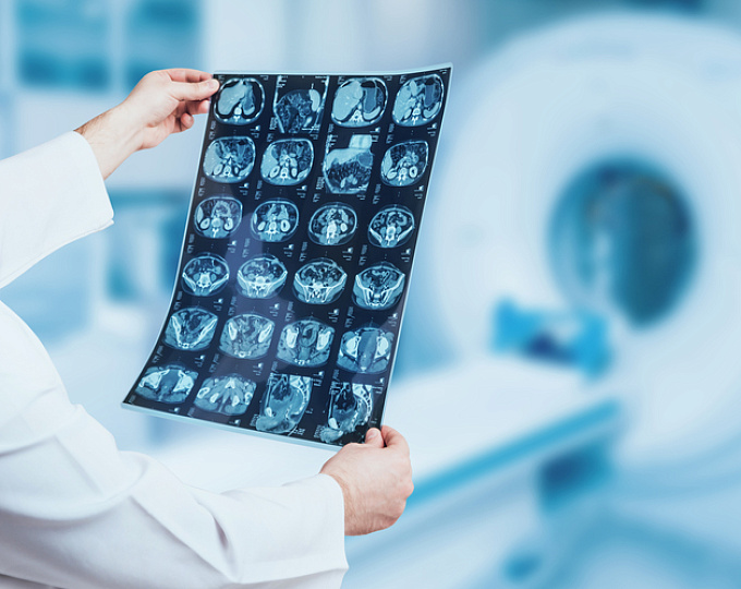 Ценность проведения МРТ головного мозга у пациентов с перым эпизодов психоза