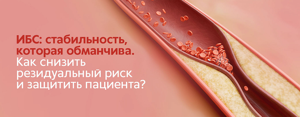 ИБС: когда "стабильность" — это ловушка? 