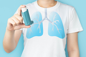 Эффективность биологической терапии при тяжелой бронхиальной астме