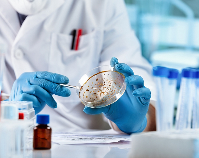 Инвазивная грибковая инфекция как фактор риска смерти при осложненном алкогольном гепатите 