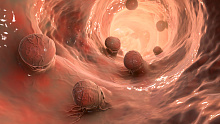 Какова связь между кишечными полипами и смертностью от гепатобилиарного рака?