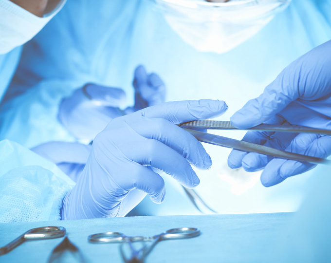 Открытое хирургическое или эндоваскулярное вмешательство при аневризме брюшной аорты: сравнение исходов