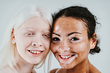 Аномальная морфология фовеолярной области у носителей глазокожного альбинизма