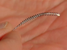 Временный запрет на использование имплантата Essure
