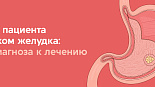 Путь пациента с раком желудка: от диагноза к лечению