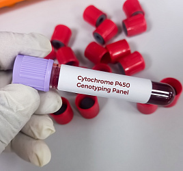 Высокая частота быстрого и ультра-быстрого метаболизма ингибиторов протонной помпы у пациентов с ГЭРБ