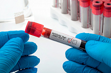 Тест на антитела после прививки против COVID-19: позиция FDA