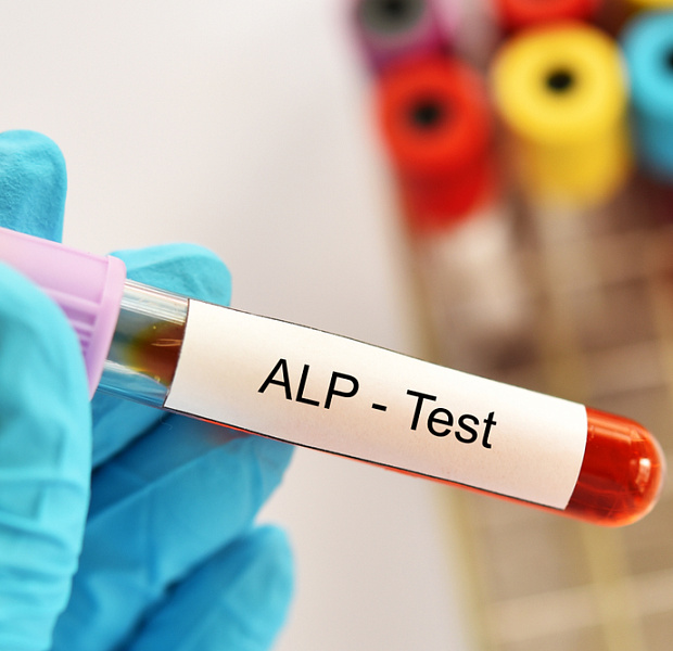 Вклад нормализации уровня щелочной фосфатазы в выживаемость без осложнений при первичном билиарном холангите