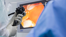 Рак прямой кишки: сравнение лапароскопии и открытого хирургического вмешательства