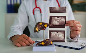 Фиброз печени как фактор риска смертности при сахарное диабете 2 типа