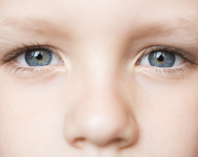 Хирургия катаракты у детей после лечения ретинобластомы