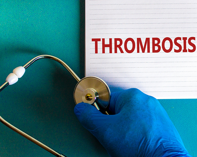 Какие факторы увеличивают вероятность разрешения тромбоза левого желудочка?