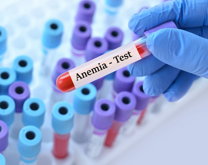Анемия ассоциирована с повышением уровня биомаркеров болезни Альцгеймера и риском деменции