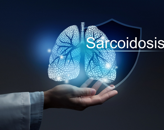 Препараты для течения саркоидоза, фокус на безопасность