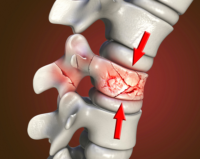 Кости в Spine