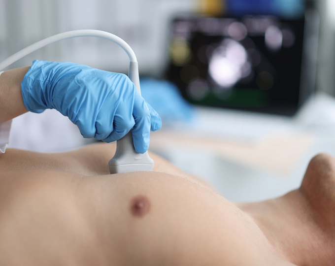 Эхокардиография перед аблацией фибрилляции предсердий