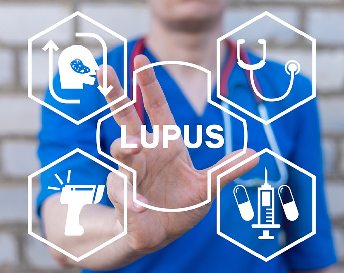 Эффективность и безопасность микофенолата мофетила в лечении системной красной волчанки