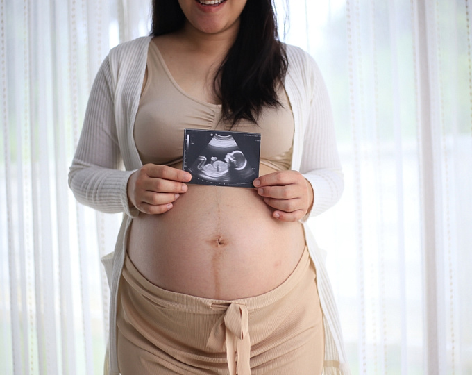 Беременность у женщин со структурной патологией сердца