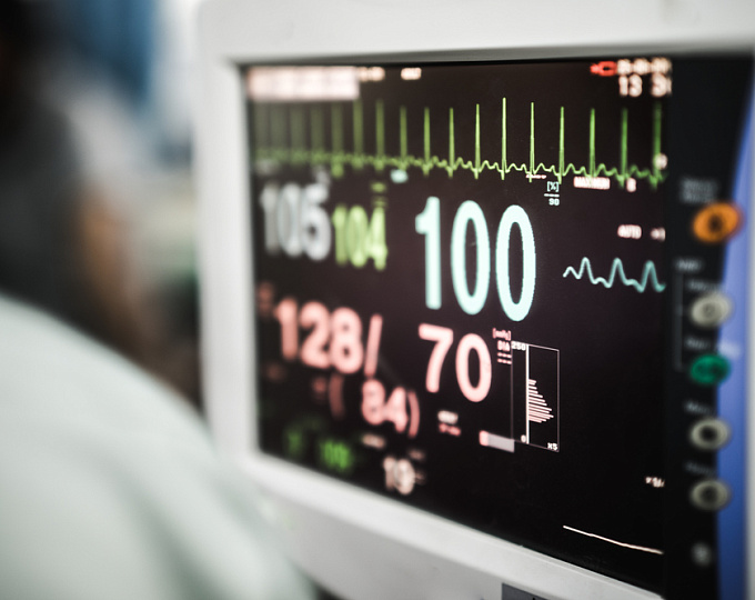 Дистанционный мониторинг давления в легочной артерии у пациентов с ХСН