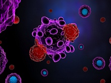 Цитомегаловирусное поражение ЖКТ на фоне иммунотерапии 
