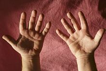 Онкологическая настороженность у пациентов с акромегалией