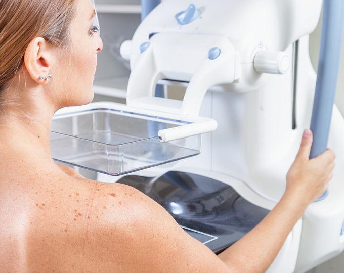 Нужна ли МРТ пациенткам с плотной тканью молочных желез, выявленной при маммографии?