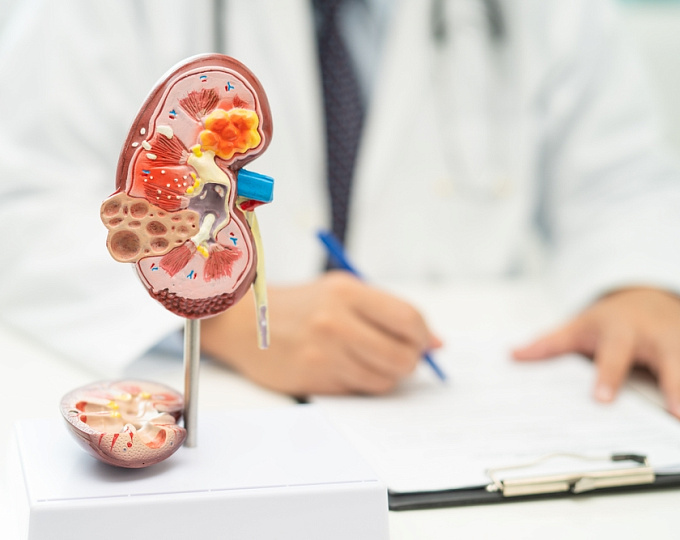 Постоперационные почечные осложнения у пациентов с воспалительным заболеванием кишечника 