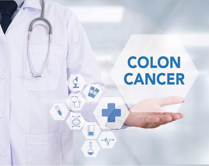 10-летний интервал между колоноскопиями - мало или много при скрининге колоректального рака?