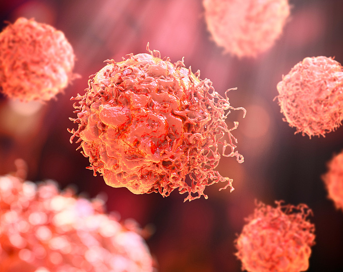 Предполагаемая зарождающаяся меланома хориоидеи: предлагаемые диагностические критерии и лечение