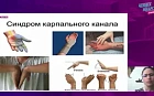 Управление проблемами опорно-двигательного аппарата при наследственных нарушениях соединительной ткани. Часть 2: лечение, реабилитация