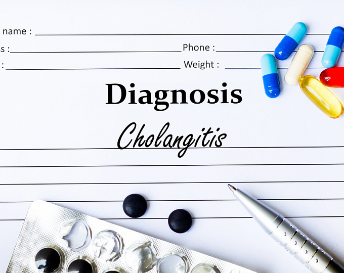 Первичный склерозирующий холангит – фактор риска колоректального рака