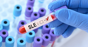 Антифосфолипидные антитела повышают риск неблагоприятных исходов беременности у женщин с системной красной волчанкой