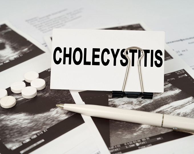 Возможна ли консервативная тактика ведения при остром холецистите?