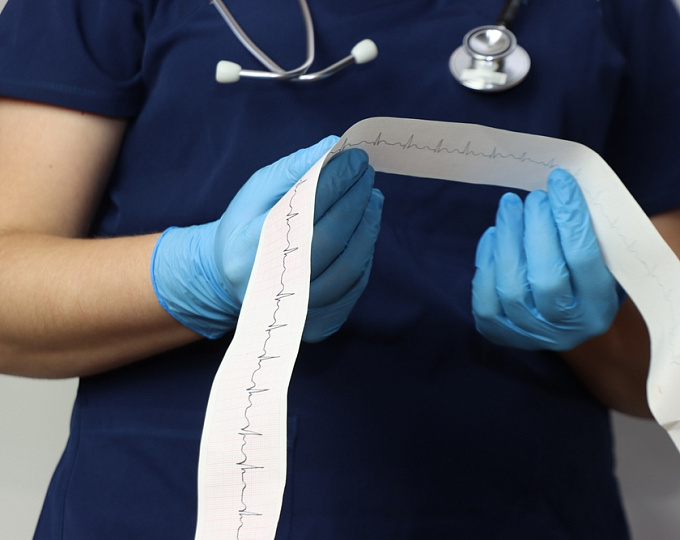 Катетерная аблация или антиаритмическая терапия желудочковой тахикардии