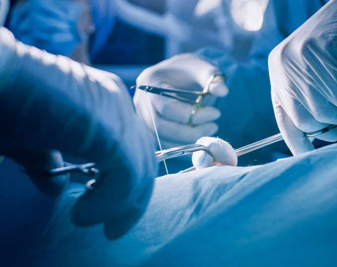 Какие факторы уменьшают вероятность послеоперационной фибрилляции предсердий?