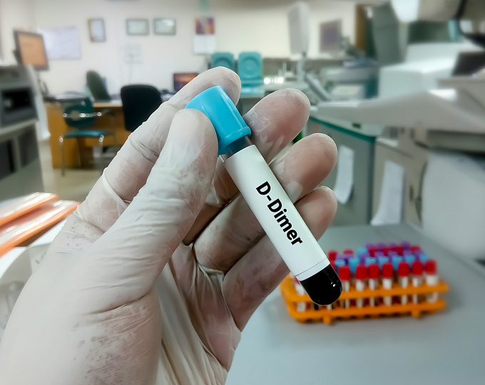 Новый метаанализ: как исключить ТЭЛА?