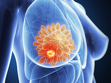 Эффективность и безопасность комбинации палбоциклиба и трастузумаба при HER2-положительном прогрессирующем раке молочной железы