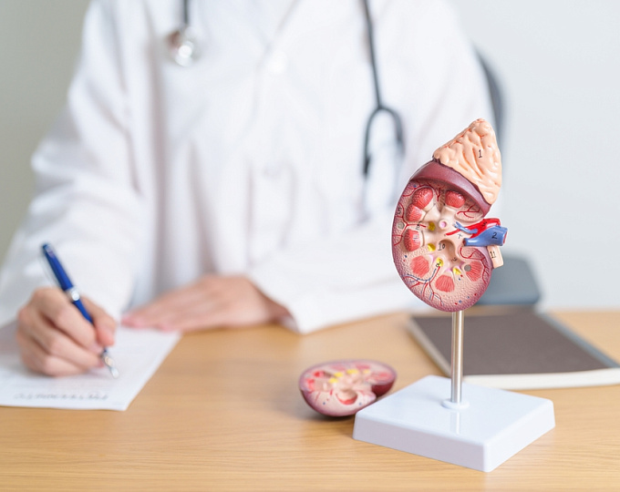 Тиазидные диуретики и мочекаменная болезнь: есть ли связь?