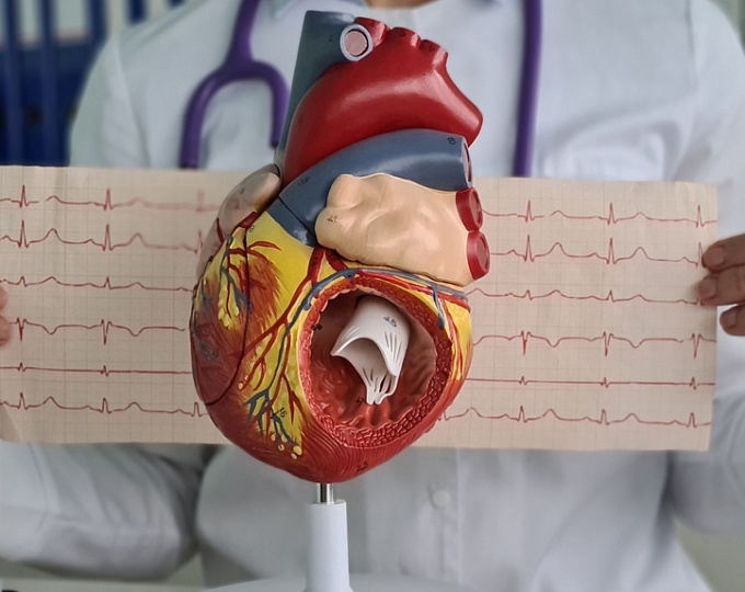 Оптимальная стратегия ведения пожилых пациентов с инфарктом миокарда без подъема сегмента ST