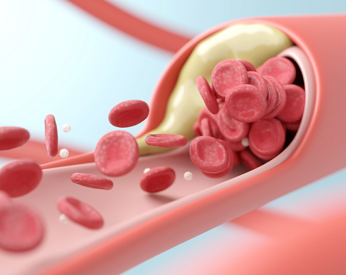 Эффективность эволокумаба в первичной профилактике сердечно-сосудистых событий 