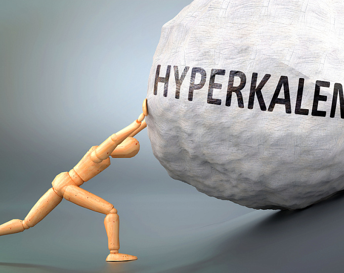 DIAMOND: патиромер в лечении гиперкалиемии у пациентов с ХСНнФВ