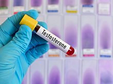 Как тестостерон-заместительная терапия влияет на уровень гемоглобина при гипогонадизме?