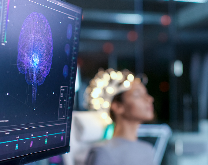 Анти-CD 20 терапия снижает гуморальный иммунный ответ к SARS-CoV-2  у пациентов с рассеянным склерозом и заболеваниями из группы оптических нейромиелитов