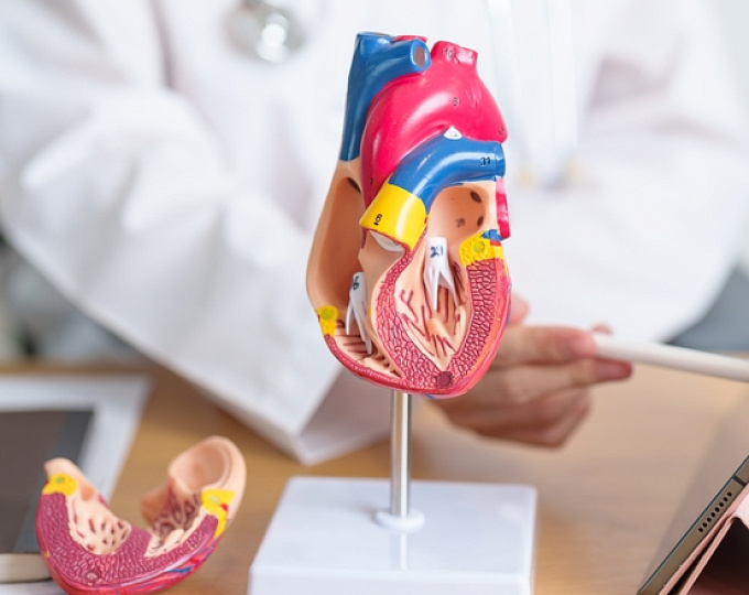 Комбинированная липидснижающая терапия после ЧКВ