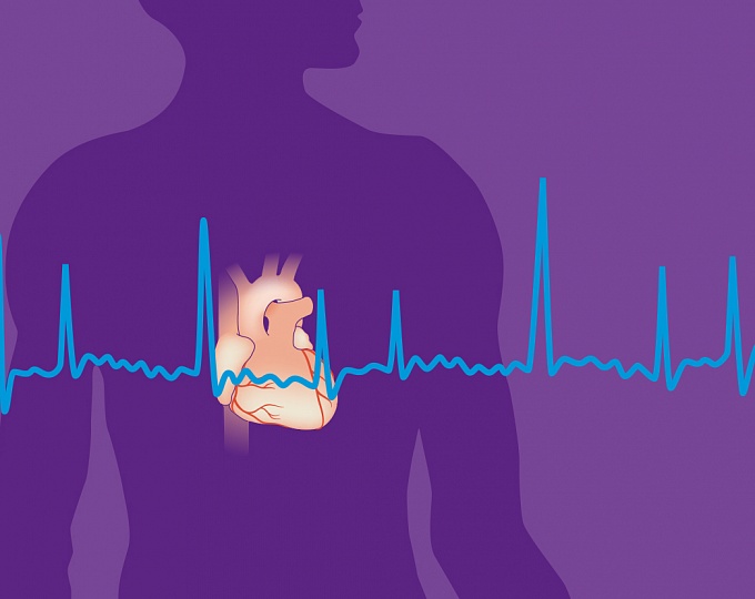 Риск острого инфаркта миокарда у пациентов с фибрилляцией предсердия, принимающих антикоагулянты 